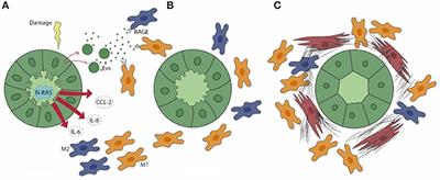 The Emerging Role of Macrophages in Chronic Cholangiopathies Featuring Biliary Fibrosis: An Attractive Therapeutic Target for Orphan Diseases